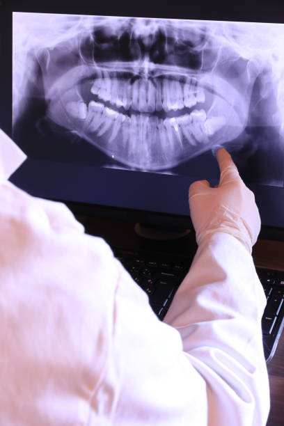 Best Emergency Dentist for Lost Fillings or Crowns in Maryland Heights, MO
