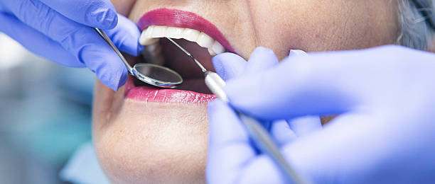 Best Emergency Dentist for Knocked-Out Tooth in Maryland Heights, MO